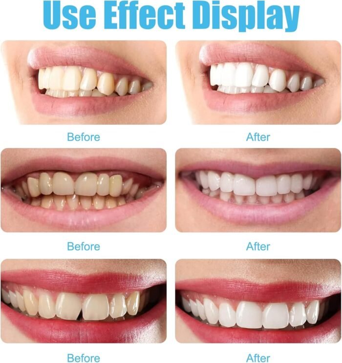 Perfect Smile Veneers Tooth Cover Dub Correction of Teeth for Bad False Teeth Instant Upper Dental Teeth Whitening Beauty Tool - Tradedubai.ae Wholesale B2B Market